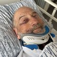 Jens Boesen blev lagt i halskrave efter et voldsomt styrt på racercykel. Privatfoto