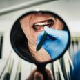 Tandlægerne oplever overalt i landet, at patienter melder afbud eller udskyder behandling. Pressefoto