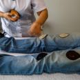 A female therapist does therapy with magnets on a patient lying on a stretcher